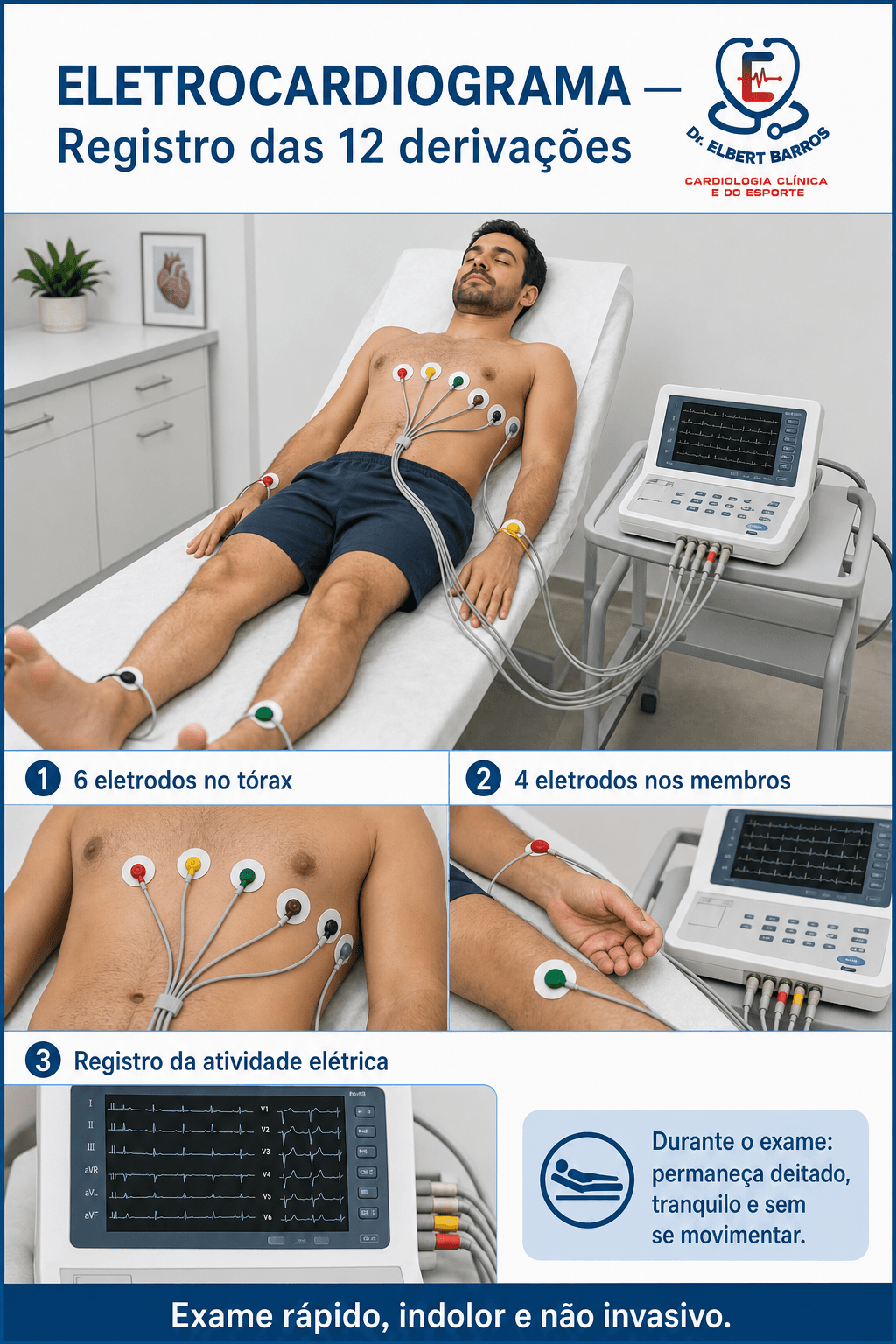 Orientações ilustradas do exame de Eletrocardiograma (ECG)